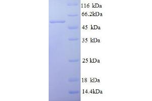 SDS-PAGE (SDS) image for V-Set Domain Containing T Cell Activation Inhibitor 1 (VTCN1) (AA 26-258), (partial) protein (GST tag) (ABIN1047882)