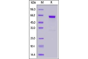 Human FOLR1, Fc Tag on  under reducing (R) condition. (FOLR1 Protein (AA 25-233) (Fc Tag))