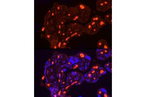 Immunofluorescence analysis of Human placenta using SLC4 antibody (7391 ) at dilution of 1:100. (Band 3/AE1 抗体  (AA 1-353))
