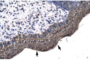 Human Spermatophore (KIN 抗体  (Middle Region))