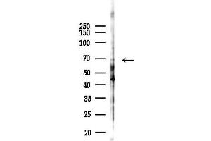 Western blot analysis of lysates from F10-LUC cells(starvation,24h treatment), using BIRC3 Antibody at 1/1000 dilution.