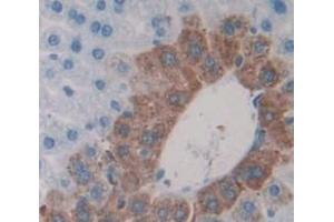 Used in DAB staining on fromalin fixed paraffin- embedded Kidney tissue (CRYBA1 抗体  (AA 1-215))