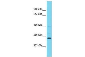 Host: Rabbit Target Name: RABL6 Sample Type: Jurkat Whole Cell lysates Antibody Dilution: 1. (C9orf86 抗体  (N-Term))