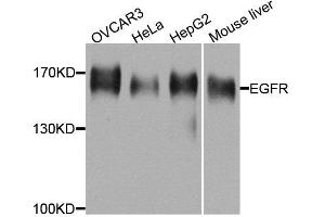 Western blot analysis of extracts of various cell lines, using EGFR antibody. (EGFR 抗体  (AA 1021-1210))