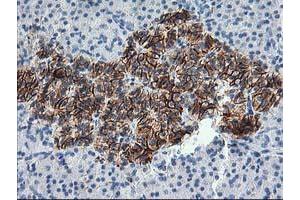 Immunohistochemical staining of paraffin-embedded Human pancreas tissue using anti-SNAP25 mouse monoclonal antibody. (SNAP25 抗体)
