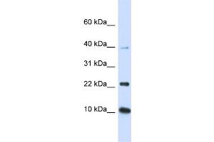 WB Suggested Anti-UBE2D2 Antibody Titration:  0. (UBE2D2 抗体  (N-Term))
