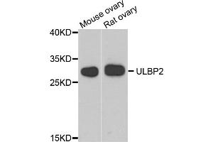 Western blot analysis of extracts of various cell lines, using ULBP2 antibody (ABIN5974540) at 1/1000 dilution. (ULBP2 抗体)