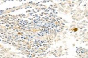 Immunohistochemistry analysis of paraffin-embedded human lymph node using PARP1 (ABIN7075114) at dilution of 1: 750 (PARP1 抗体  (cleaved))