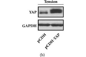 Forced overexpression of YAP promotes the osteogenic differentiation of HPDLCs. (YAP1 抗体)