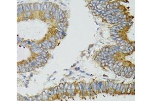 Immunohistochemistry (Paraffin-embedded Sections) (IHC (p)) image for anti-Mitochondrially Encoded NADH Dehydrogenase 5 (MT-ND5) antibody (ABIN7264181)