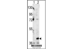 Western blot analysis of P38 using P38 Antibody using 293 cell lysates (2 ug/lane) either nontransfected (Lane 1) or transiently transfected with the MAPK14 gene (Lane 2). (MAPK14 抗体  (C-Term))