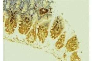 ABIN6279064 at 1/100 staining Mouse colon tissue by IHC-P. (LPGAT1 抗体  (Internal Region))