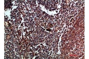 Immunohistochemistry (IHC) image for anti-Cyclin-Dependent Kinase 6 (CDK6) (AA 280-325) antibody (ABIN7189478)