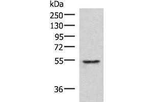 Western blot analysis of Jurkat cell lysate using TUBD1 Polyclonal Antibody at dilution of 1:1000 (TUBD1 抗体)