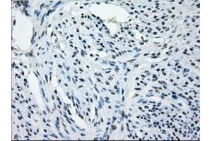 Immunohistochemical staining of paraffin-embedded Kidney tissue using anti-AURKCmouse monoclonal antibody. (Aurora Kinase C 抗体)