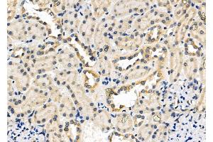 ABIN6257793 and ABIN6276233 at 1/100 staining Rat kidney tissue by IHC-P. (AVPR2 抗体  (Internal Region))