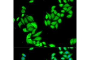 Immunofluorescence analysis of HeLa cells using IKK beta Polyclonal Antibody (IKBKB 抗体)