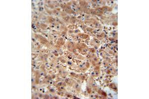 Immunohistochemistry (Paraffin-embedded Sections) (IHC (p)) image for anti-ArfGAP with SH3 Domain, Ankyrin Repeat and PH Domain 3 (ASAP3) (AA 26-54), (N-Term) antibody (ABIN654956)