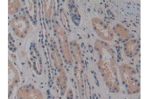 DAB staining on IHC-P; Samples: Human Kidney Tissue (NOSIP 抗体  (AA 62-295))