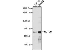 Western blot analysis of extracts of various cell lines, using NOTUM antibody (ABIN7268961) at 1:1000 dilution. (NOTUM 抗体  (AA 20-320))