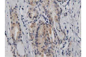 Image no. 11 for anti-DnaJ (Hsp40) Homolog, Subfamily A, Member 2 (DNAJA2) antibody (ABIN1497862)