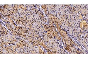 Detection of TF in Porcine Kidney Tissue using Polyclonal Antibody to Transferrin (TF) (Transferrin 抗体)