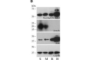 Western Blotting (WB) image for anti-Actin, Alpha, Cardiac Muscle 1 (ACTC1) antibody (ABIN2855212)