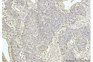 IHC analysis of GRPEL1 using anti-GRPEL1 antibody (ABIN7602643). (GRPEL1 抗体  (AA 90-217))