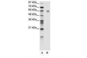Image no. 1 for anti-FEZ Family Zinc Finger 2 (FEZF2) (C-Term) antibody (ABIN203150) (FEZF2 抗体  (C-Term))