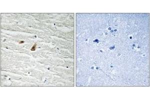 Immunohistochemistry analysis of paraffin-embedded human brain, using C/EBP-epsilon (Phospho-Thr74) Antibody. (CEBPE 抗体  (pThr74))