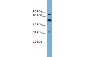 WB Suggested Anti-TLK2 Antibody Titration: 0. (TLK2 抗体  (N-Term))