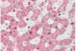 Immunohistochemistry (IHC) image for anti-Zinc Finger, CCCH-Type with G Patch Domain (ZGPAT) (N-Term) antibody (ABIN6754898)