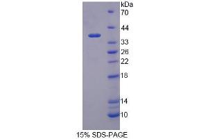 SDS-PAGE analysis of Human TIF1b Protein. (KAP1 蛋白)