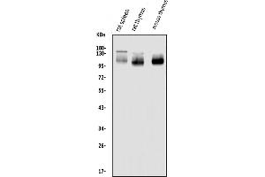 Western blot analysis of SELPLG using anti-SELPLG antibody (ABIN7600337). (SELPLG 抗体  (AA 18-397))