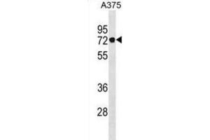 Western Blotting (WB) image for anti-Podocan (PODN) antibody (ABIN3001059) (Podocan 抗体)