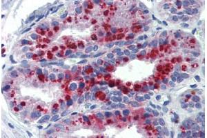 Human Prostate: Formalin-Fixed, Paraffin-Embedded (FFPE) (KCNK9 抗体  (AA 36-85))