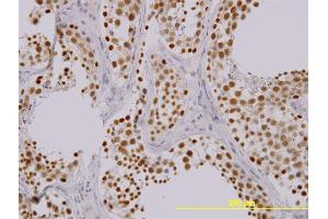 Immunoperoxidase of monoclonal antibody to TAOK1 on formalin-fixed paraffin-embedded human testis. (TAO Kinase 1 (TAOK1) (AA 892-1001) 抗体)