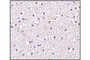 Immunohistochemistry of Nicastrin in human brain tissue with this product at 5 μg/ml. (Nicastrin 抗体  (C-Term))