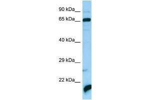 WB Suggested Anti-ATAD3A Antibody Titration: 1. (ATAD3A 抗体  (C-Term))