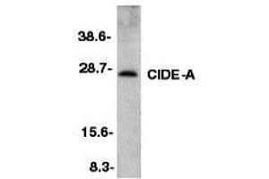 Western Blotting (WB) image for anti-Cell Death-Inducing DFFA-Like Effector A (CIDEA) (C-Term) antibody (ABIN1030334) (CIDEA 抗体  (C-Term))