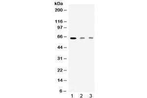 Western blot testing of 1) rat skeletal muscle, 2) human HeLa and 3) human MCF7 lysate with AMHR2 antibody at 0.