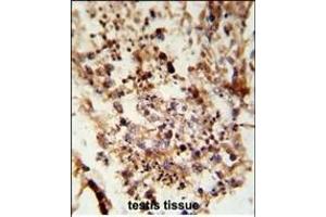 Formalin-fixed and paraffin-embedded human testis tissue reacted with ACR Antibody (C-term), which was peroxidase-conjugated to the secondary antibody, followed by DAB staining. (Acrosin 抗体  (C-Term))