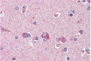 Immunohistochemistry (IHC) image for anti-Platelet-Activating Factor Acetylhydrolase 1b, Regulatory Subunit 1 (45kDa) (PAFAH1B1) (C-Term) antibody (ABIN184751)