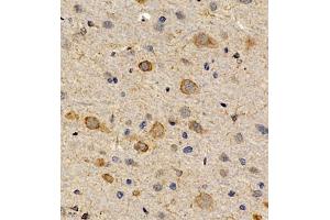 Immunohistochemistry of paraffin embedded rat brain using CCRL2 (ABIN7073461) at dilution of 1:300 (400x lens) (CCRL2 抗体)