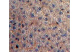 Used in DAB staining on fromalin fixed paraffin-embedded Liver tissue (SAA4 抗体  (AA 19-130))