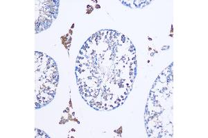 Immunohistochemistry of paraffin-embedded Mouse testis using TGN46/TGN46/TGOLN2 Rabbit pAb (ABIN7270876) at dilution of 1:100 (20x lens). (TGOLN2 抗体)
