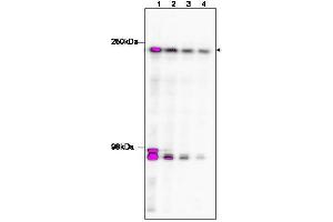 Western Blotting (WB) image for anti-TAF1 RNA Polymerase II, TATA Box Binding Protein (TBP)-Associated Factor, 250kDa (TAF1) (C-Term) antibody (ABIN233826)
