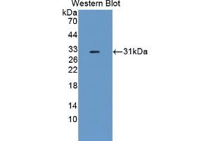 Western blot analysis of the recombinant protein. (Complement Factor I 抗体  (AA 358-603))