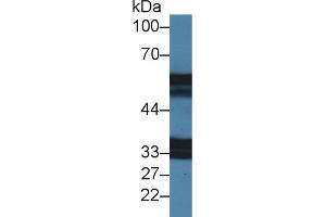 Western blot analysis of Mouse Stomach lysate, using Mouse IL18R1 Antibody (2 µg/ml) and HRP-conjugated Goat Anti-Rabbit antibody ( (IL18R1 抗体  (AA 182-336))