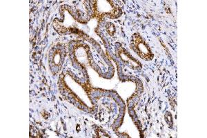 IHC analysis of COX6B1 using anti-COX6B1 antibody (ABIN7603206).